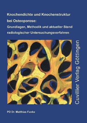 Knochendichte und Knochenstruktur bei Osteoporose: Grundlagen, Methodik und aktueller Stand radiologischer Untersuchungsverfahren de Matthias Funke