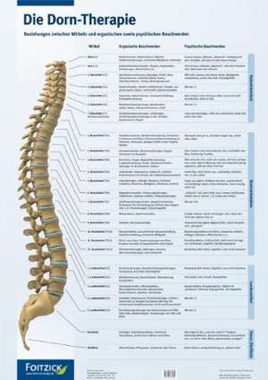 Die Dorn-Therapie. Poster 59,4 x 84 cm de Matthias Schwarz