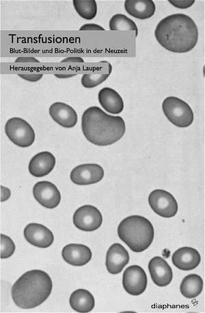 Transfusionen de Anja Lauper