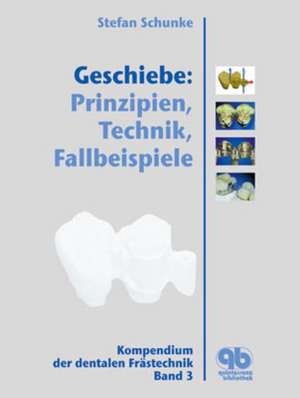 Geschiebe: Prinzipien, Technik, Fallbeispiele: Funktionsweise der Geschiebe, Individuelle Primärteile, Sekundärteile, Patientenfälle de Stefan Schunke