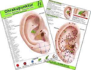 Ohrakupunktur - Indikation: Nahrungsmittelallergie - chinesische Ohrakupunktur