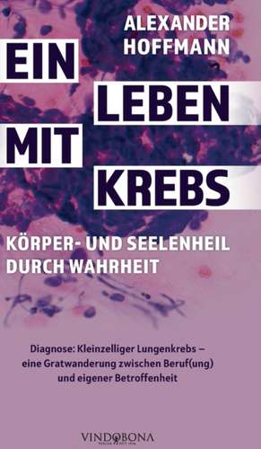 Ein Leben mit Krebs ¿ Körper- und Seelenheil durch Wahrheit de Alexander Hoffmann