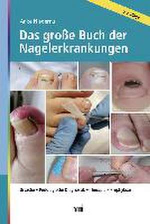 Das große Buch der Nagelerkrankungen de Anke Niederau