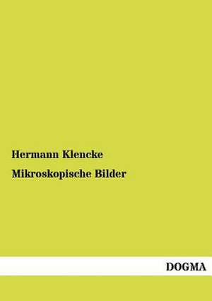 Mikroskopische Bilder de Hermann Klencke