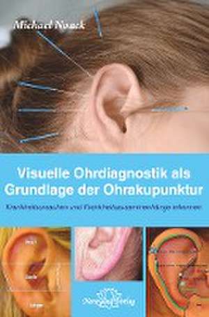 Visuelle Ohrdiagnostik als Grundlage der Ohrakupunktur de Michael Noack