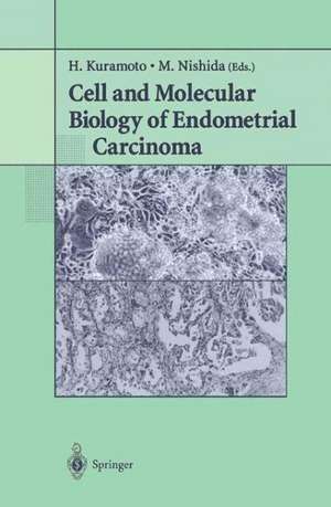 Cell and Molecular Biology of Endometrial Carcinoma de H. Kuramoto