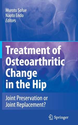 Treatment of Osteoarthritic Change in the Hip: Joint Preservation or Joint Replacement? de M. Sofue