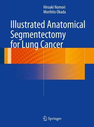 Illustrated Anatomical Segmentectomy for Lung Cancer de Hiroaki Nomori