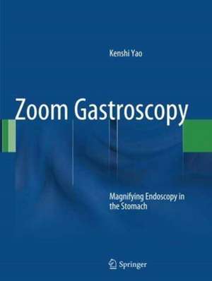 Zoom Gastroscopy: Magnifying Endoscopy in the Stomach de Kenshi Yao