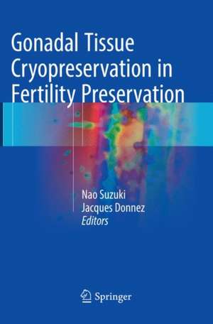 Gonadal Tissue Cryopreservation in Fertility Preservation de Nao Suzuki