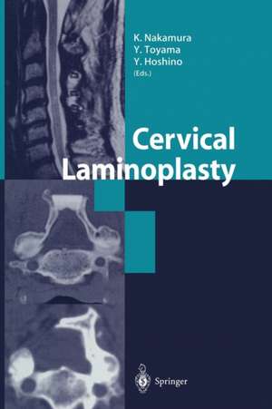 Cervical Laminoplasty de K. Nakamura