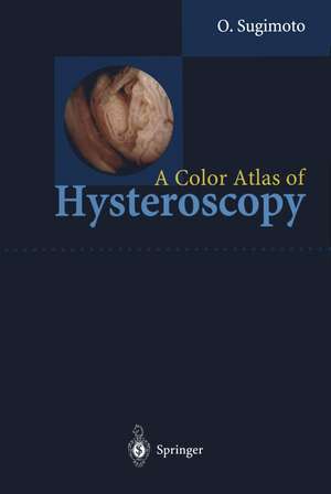 A Color Atlas of Hysteroscopy de Osamu Sugimoto