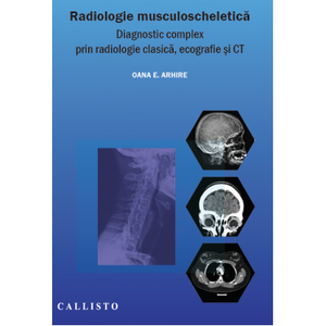 Radiologie musculo-scheletică, diagnostic complex prin radiologie clasică, ecografie și CT de Arhire Elena Oana