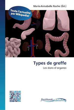 Types de greffe de Marie-Annabelle Roche