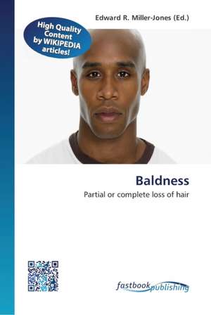 Baldness de Edward R Miller-Jones