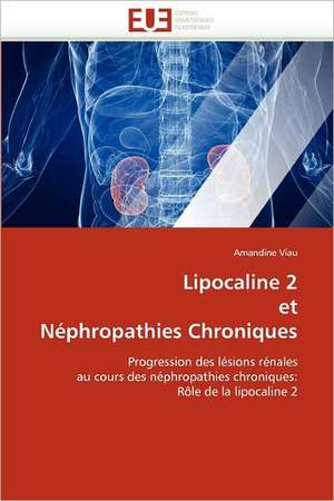 Lipocaline 2 et Néphropathies Chroniques de Amandine Viau