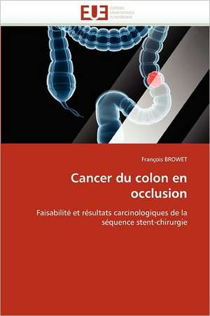 Cancer du colon en occlusion de François Browet