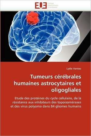 Tumeurs cérébrales humaines astrocytaires et oligogliales de Lydie Venteo