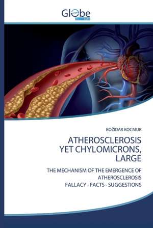 ATHEROSCLEROSIS YET CHYLOMICRONS, LARGE de Bo¿Idar Kocmur