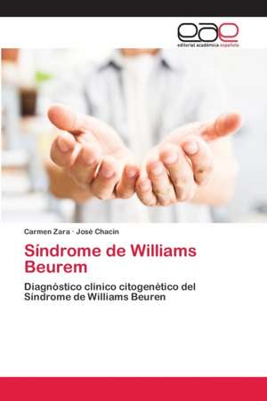 Síndrome de Williams Beurem de Carmen Zara