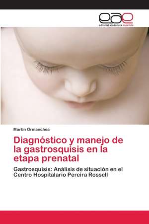 Diagnóstico y manejo de la gastrosquisis en la etapa prenatal de Martin Ormaechea