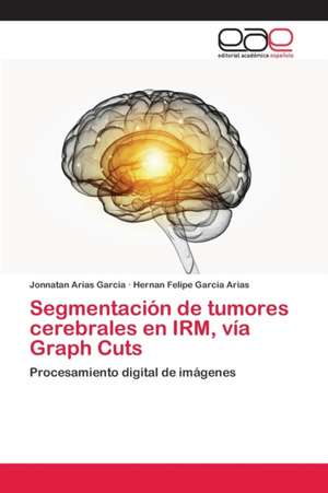 Segmentación de tumores cerebrales en IRM, vía Graph Cuts de Jonnatan Arias Garcia