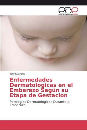 Enfermedades Dermatologicas en el Embarazo Según su Etapa de Gestacion de Tefy Guamán