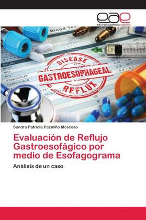 Evaluación de Reflujo Gastroesofágico por medio de Esofagograma de Sandra Patricia Pazmiño Moscoso