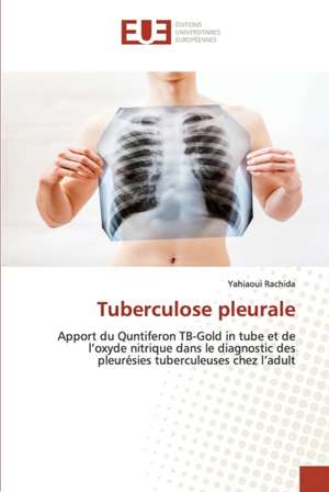 Tuberculose pleurale de Yahiaoui Rachida