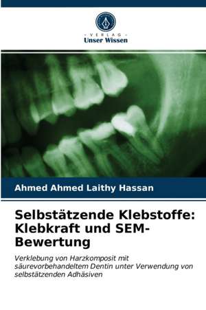 Selbstätzende Klebstoffe: Klebkraft und SEM-Bewertung de Ahmed Ahmed Laithy Hassan