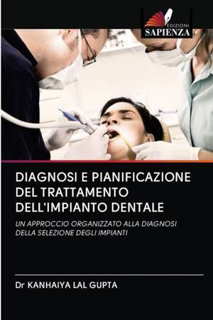 DIAGNOSI E PIANIFICAZIONE DEL TRATTAMENTO DELL'IMPIANTO DENTALE de Kanhaiya Lal Gupta