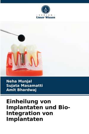 Einheilung von Implantaten und Bio- Integration von Implantaten de Neha Munjal