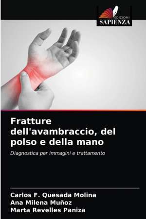 Fratture dell'avambraccio, del polso e della mano de Carlos F. Quesada Molina