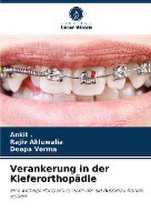 Verankerung in der Kieferorthopädie de Ankit