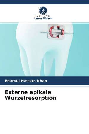 Externe apikale Wurzelresorption de Enamul Hassan Khan