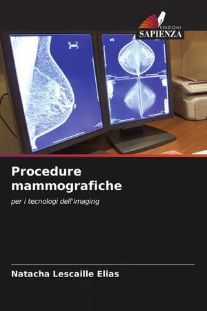 Procedure mammografiche de Natacha Lescaille Elias