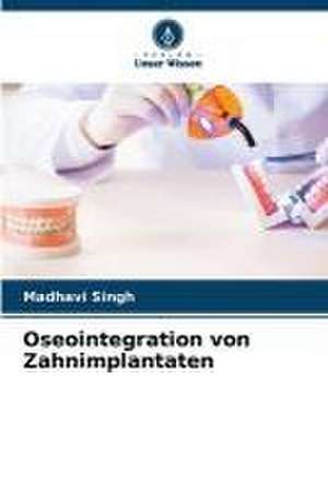 Oseointegration von Zahnimplantaten de Madhavi Singh