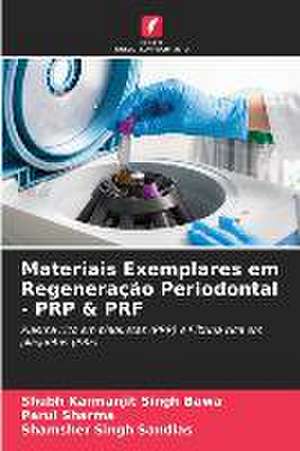 Materiais Exemplares em Regeneração Periodontal - PRP & PRF de Shubh Karmanjit Singh Bawa