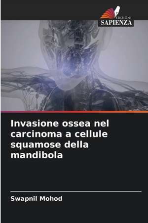 Invasione ossea nel carcinoma a cellule squamose della mandibola de Swapnil Mohod