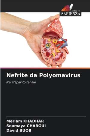 Nefrite da Polyomavirus de Meriam Khadhar