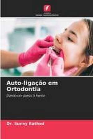 Auto-ligação em Ortodontia de Sunny Rathod