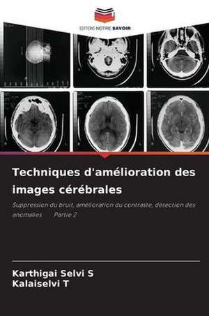 Techniques d'amélioration des images cérébrales de Karthigai Selvi S