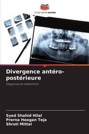 Divergence antéro-postérieure de Syed Shahid Hilal