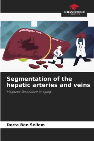 Segmentation of the hepatic arteries and veins de Dorra Ben Sellem