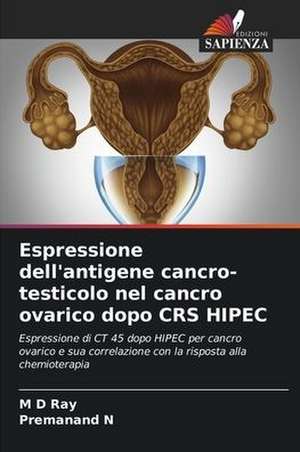 Espressione dell'antigene cancro-testicolo nel cancro ovarico dopo CRS HIPEC de M D Ray