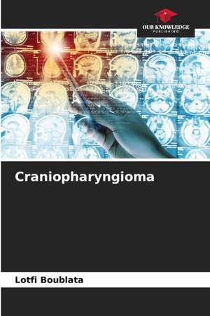 Craniopharyngioma de Lotfi Boublata