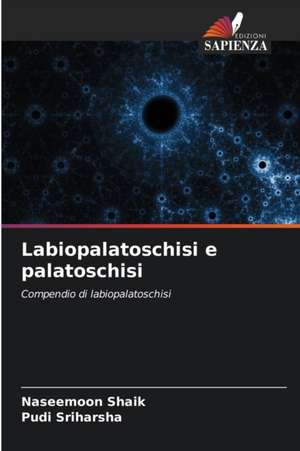 Labiopalatoschisi e palatoschisi de Naseemoon Shaik