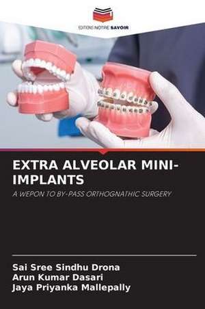 EXTRA ALVEOLAR MINI-IMPLANTS de Sai Sree Sindhu Drona