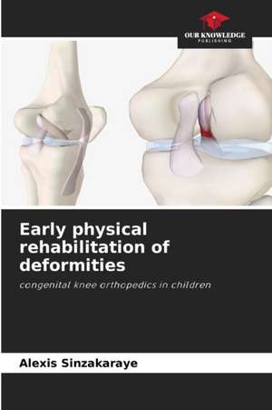 Early physical rehabilitation of deformities de Alexis Sinzakaraye