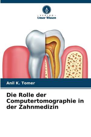 Die Rolle der Computertomographie in der Zahnmedizin de Anil K. Tomer